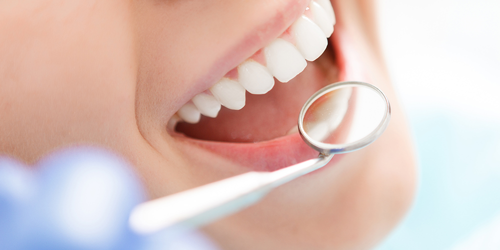 Zahnreinigung in Hof: Mundgesundheit erhalten! 